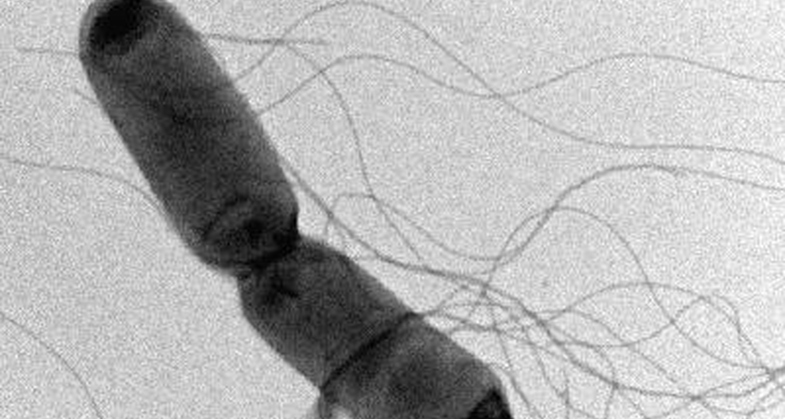 Salmonella Under the Microscope 1